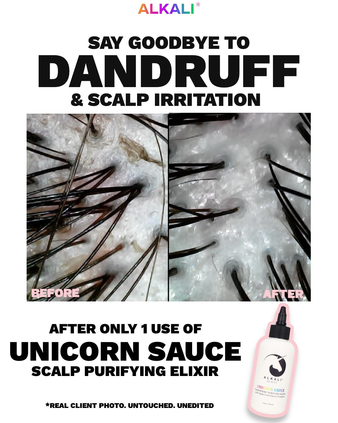 Unicorn sauce - Microbiome Scalp Elixir